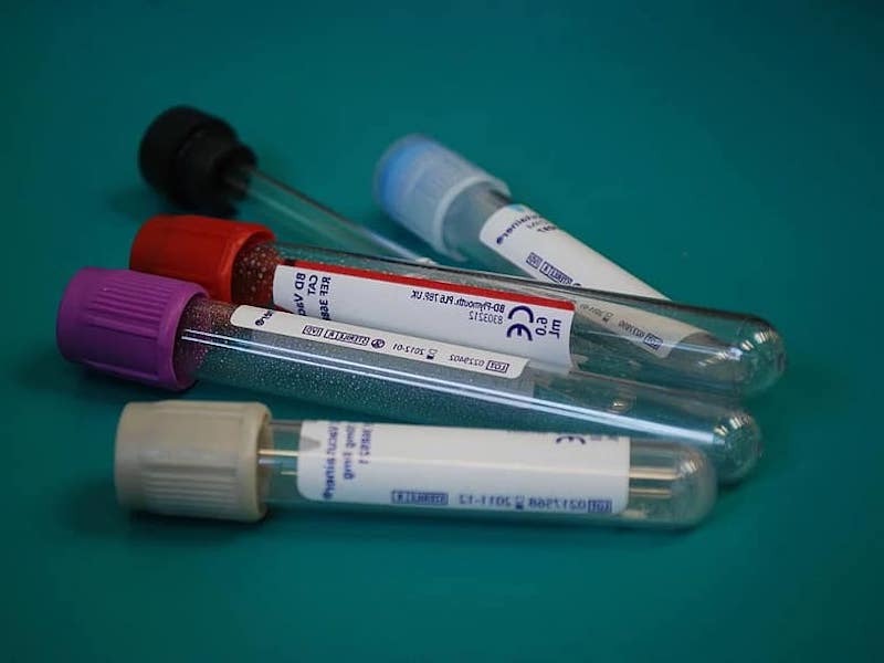 test tubes